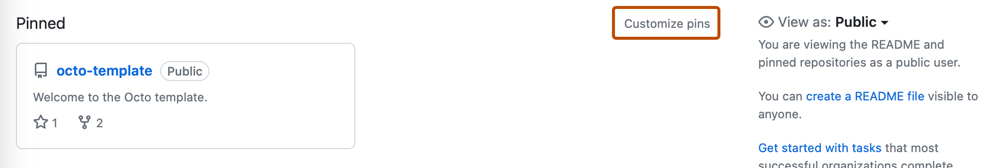 组织的配置文件页的屏幕截图。 在“已固定”部分的右上角,“自定义固定”用深橙色框出。